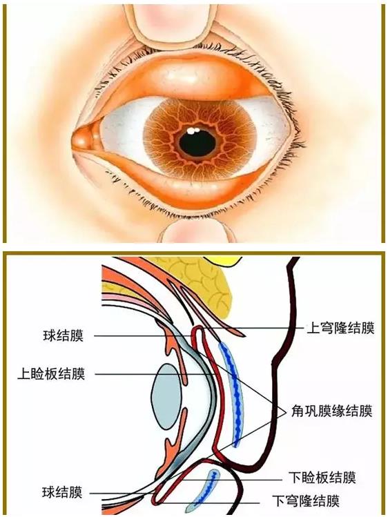 干眼